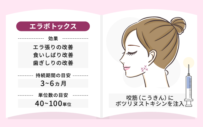 エラボトックス おすすめクリニック 効果 期間