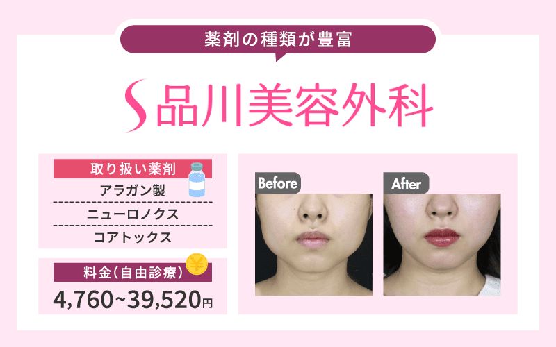 エラボトックス おすすめクリニック 品川美容外科