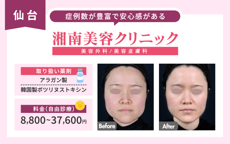 仙台 エラボトックス 湘南美容クリニック
