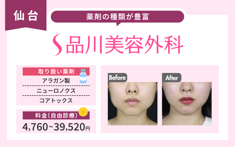 仙台 エラボトックス 品川美容外科