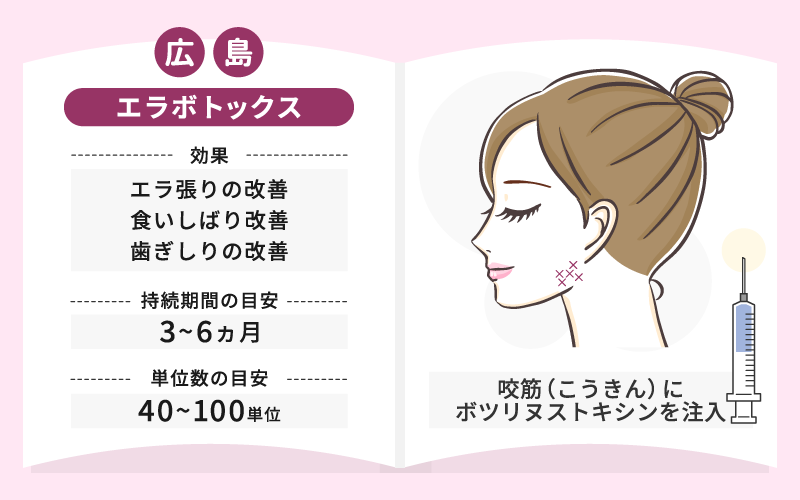 エラボトックスとは 効果 持続期間