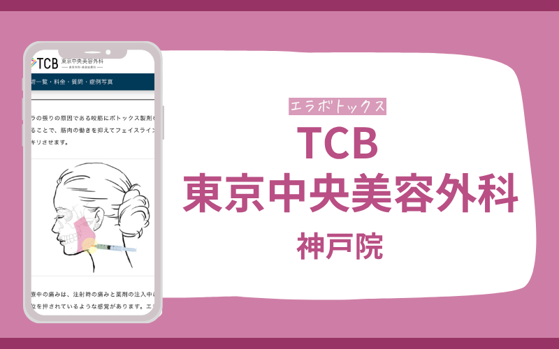 エラボトックス　神戸　TCB東京中央美容外科