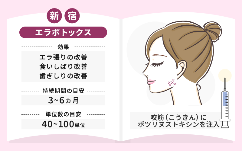 エラボトックスとは 効果 持続期間