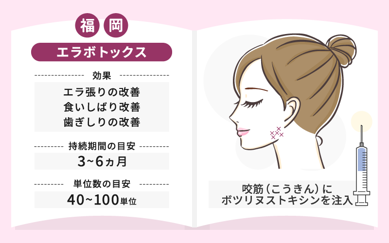 エラボトックス とは 効果 持続期間
