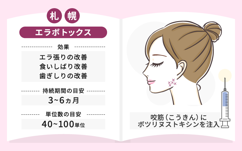札幌のエラボトックス効果