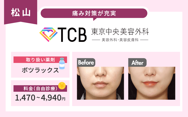 エラボトックス　松山　TCB東京中央美容外科　図解