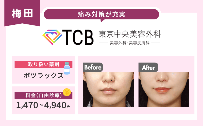 エラボトックス　梅田　TCB東京中央美容外科　図解