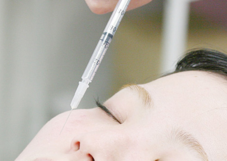 ボトックス修正