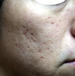 o2336350415130912260