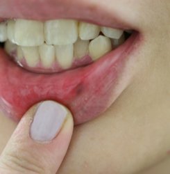 o3504233614352074869