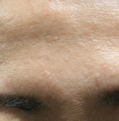 o1523107415620661278