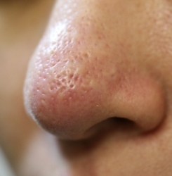 o3504233615691663860