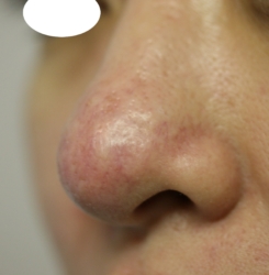 o3504233615691663866