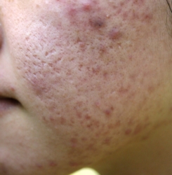 o1728239114528817561