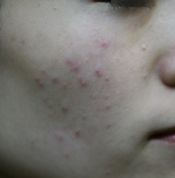 o2336350414287567753