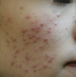 o2336350414287567754