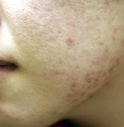 o2336350414528817557