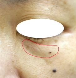 o3504233615724497680