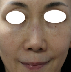 o1694217915739756347