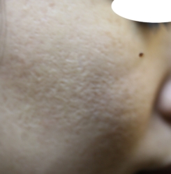 o2336217515732061216