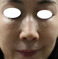 o2336320215739756351