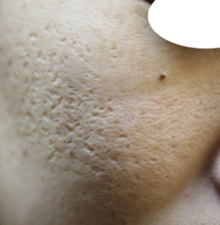 o2966233615732061219