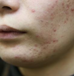 o3504233614483798684