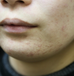 o3504233614483798691