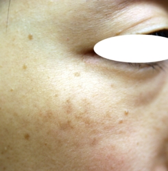 o3504233615249187000