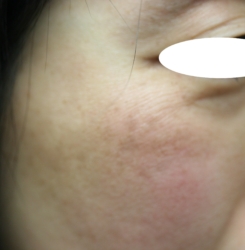 o3504233615249187003