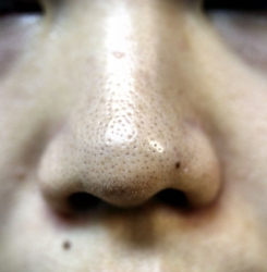 o3504233615325611100 (1)