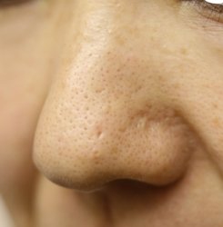 o2336350415019625369