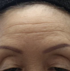 o1536102415764898294