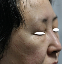 o1818232115759230709