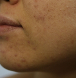 o2313181315760400016 (1)