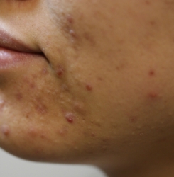 o2690200715760400014