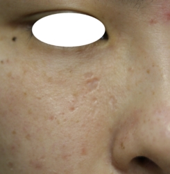 o3504233615760121826