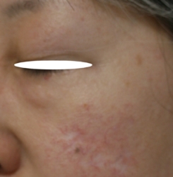o1551130715777978172
