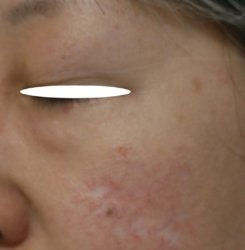 o1551130715777978172